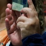 Vitíligo no es contagioso, sino un trastorno inmunológico: Salud Colima